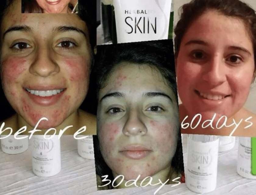 sensitive skin, skin party